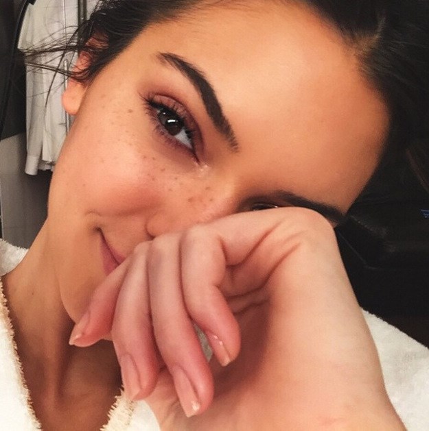 Dermatolog Kendall Jenner otkriva: Ove pogreške najčešće rade cure s aknama