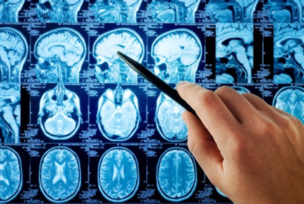 Revolucionarno otkriće koje će promijeniti medicinske udžbenike