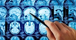 Znanstvenici tvrde da su osobe koje pretrpe ozljedu mozga religioznije