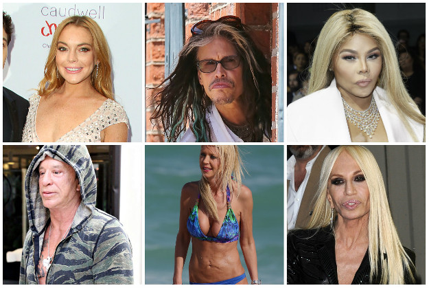 Zona sumraka: Celebrityji koje su plastični kirurzi potpuno uništili
