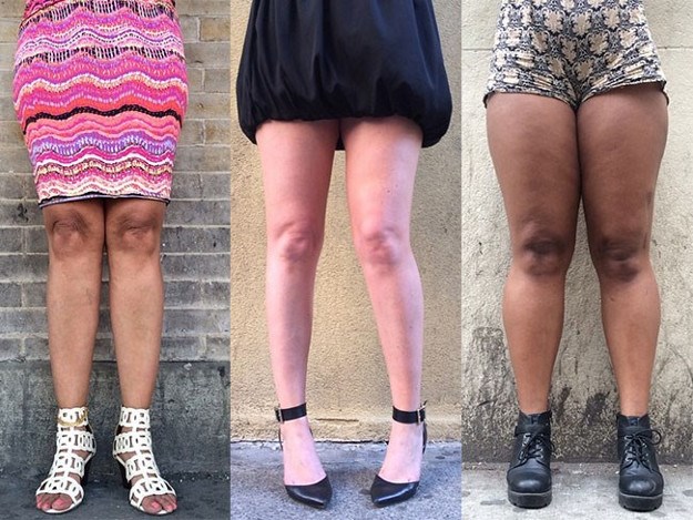 Foto projekt koji slavi ljepotu ženskih nogu - u svim oblicima