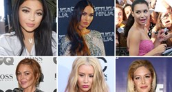 Još nemaju ni 30: Slavne ljepotice koje su lica izobličile botoxom i plastičnom kirurgijom