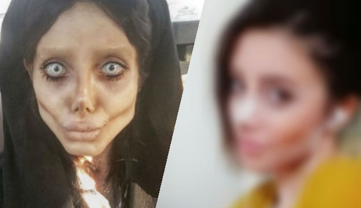 FOTO Evo kako je nekad izgledala cura koja se operirala 50 puta da sliči Angelini Jolie