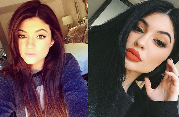 Upoznajte čovjeka koji je zaslužan za nevjerojatnu transformaciju Kylie Jenner