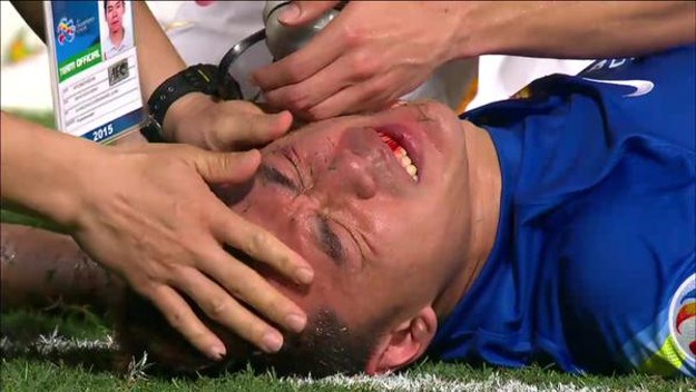 Uznemirujući video: Golman kineskog prvaka u sudaru sa suigračem dobio peterostruki prijelom kostiju lica!