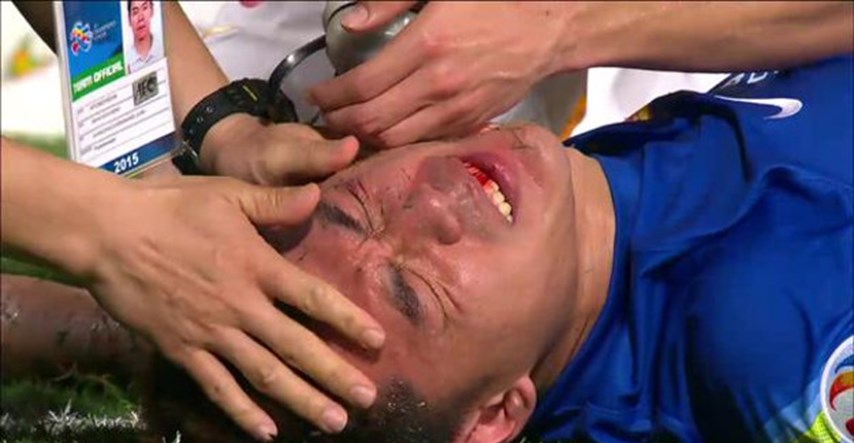 Uznemirujući video: Golman kineskog prvaka u sudaru sa suigračem dobio peterostruki prijelom kostiju lica!