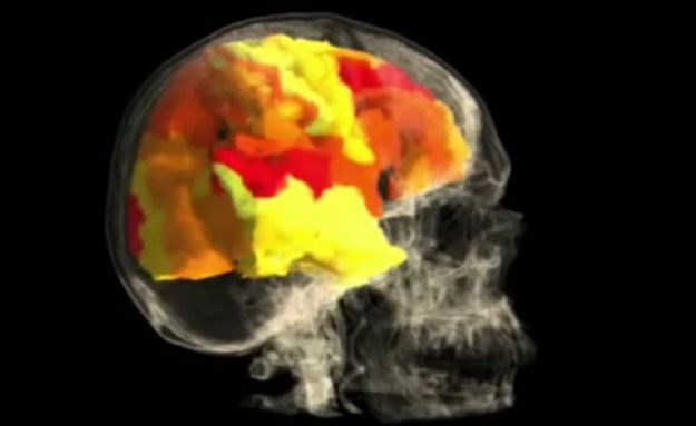 Kakav vatromet: Pogledajte snimku ženskog mozga tijekom orgazma