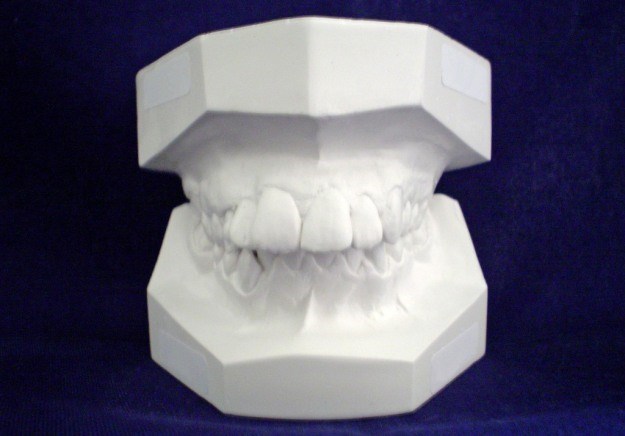 AZTN pogriješila: Ortodonti nisu narušili tržišno natjecanje