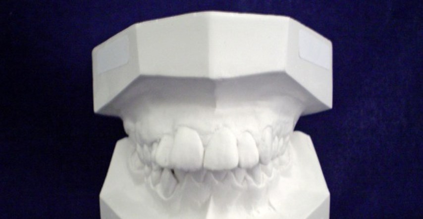 AZTN pogriješila: Ortodonti nisu narušili tržišno natjecanje