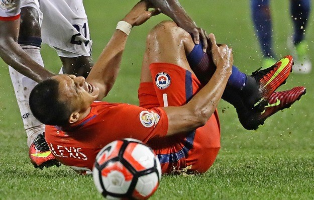 UŽASNA FOTKA Pogledajte kako je Alexisu Sanchezu natekla noga