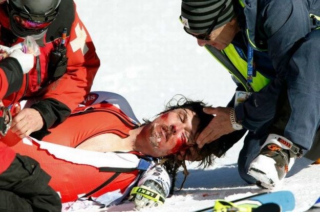 Bank se izvukao nakon dramatičnog pada, pomiče noge i nema ozljede mozga