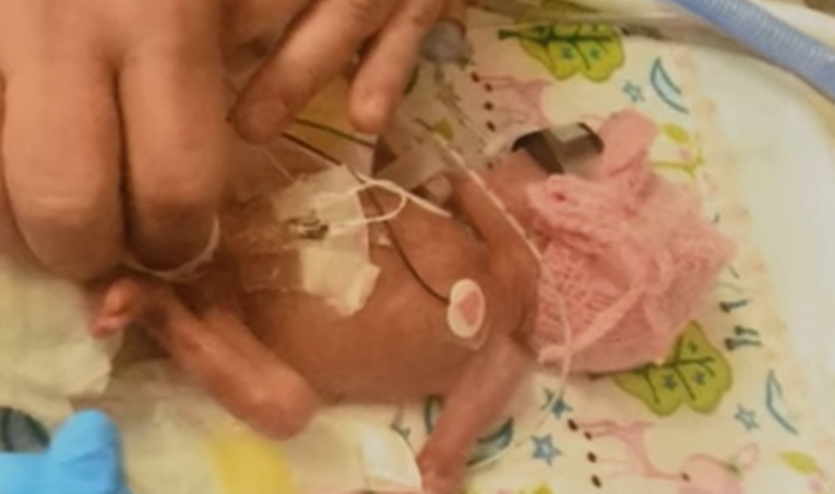 VIDEO Rodila se sa samo 620 grama, liječnici su rekli da neće preživjeti, no ona ih je iznenadila
