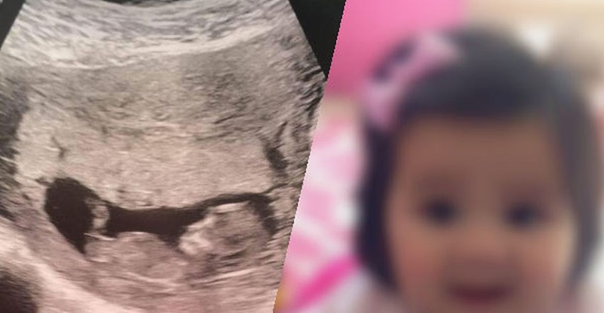 Ultrazvuk ove bebe iznenadio je liječnike, a kad se rodila, njena mama nije mogla vjerovati što vidi