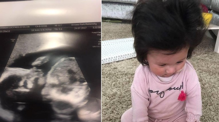 Mali Elvis Presley: Još na ultrazvuku se vidjelo da će beba imati puno kose