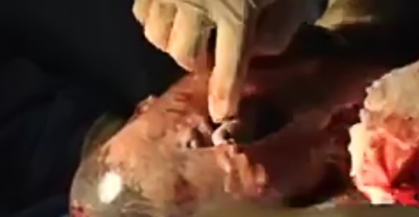 Predivan video prvog udaha bebe rođene u vodenjaku - ovo se tako rijetko viđa!