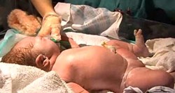 Znate li kako točno čiste i pregledavaju bebu odmah nakon poroda?
