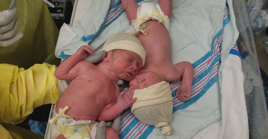 Nerazdvojni od rođenja: Blizanci tješili jedan drugog nakon poroda