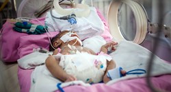DRUGI SLUČAJ U SVIJETU U Klaićevoj spasili bebu rođenu sa samo 450 grama