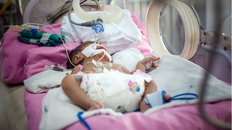 DRUGI SLUČAJ U SVIJETU U Klaićevoj spasili bebu rođenu sa samo 450 grama