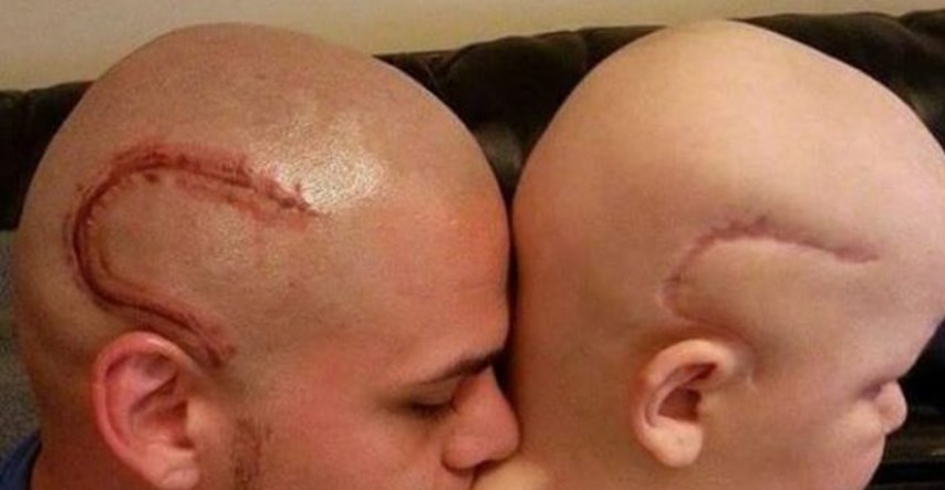 FOTO Otac tetovirao glavu da ohrabri sina oboljelog od raka