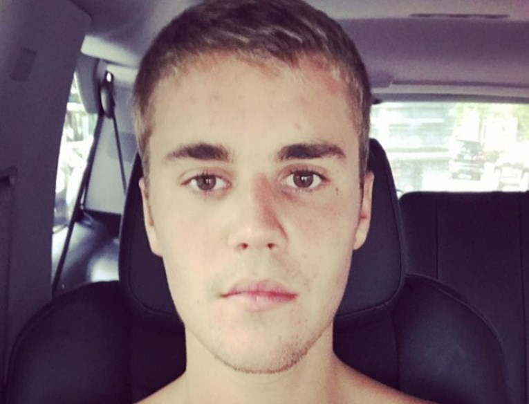 Bieber otkrio da ima zdravstvenih problema, fanovi se već mole za njega