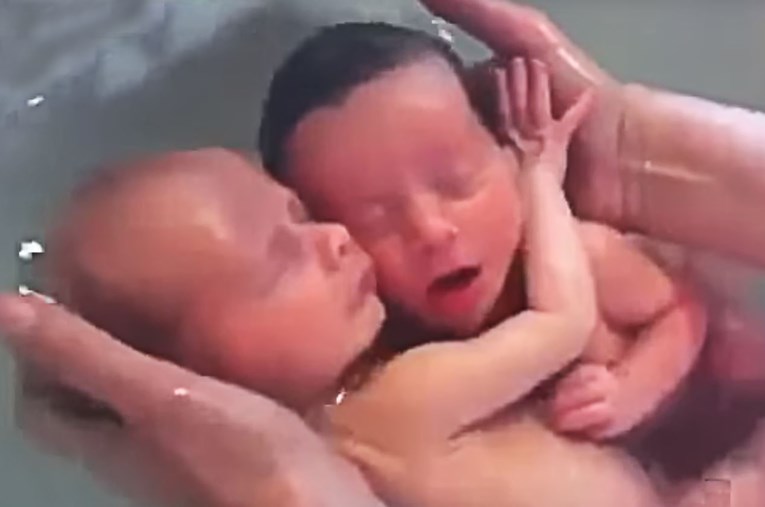 Zavirite u svijet (ne)rođenih blizanaca - ovo je ljubav koja nema premca