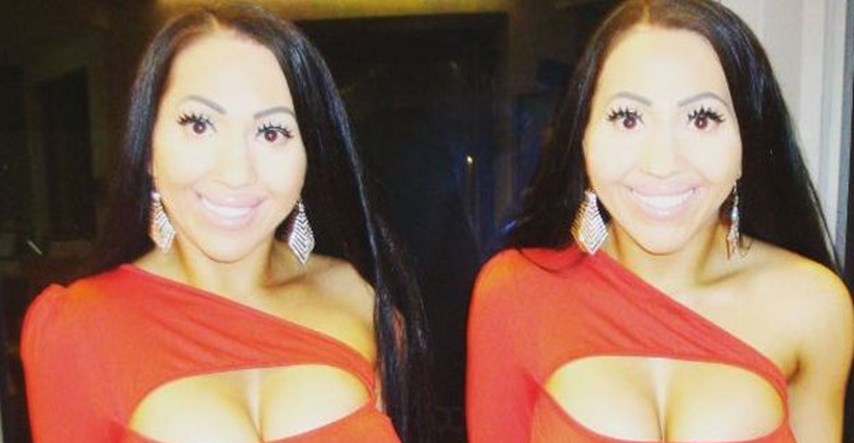 FOTO Sise im presudile: "Najidentičnije" blizanke na svijetu shrvane jer ipak nisu iste