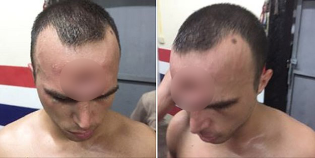UZNEMIRUJUĆE FOTOGRAFIJE Borac doživio stravičnu ozljedu glave