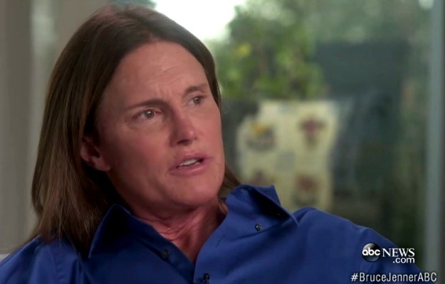 Bruce Jenner navodno podvrgnut osmosatnoj operaciji promjene spola