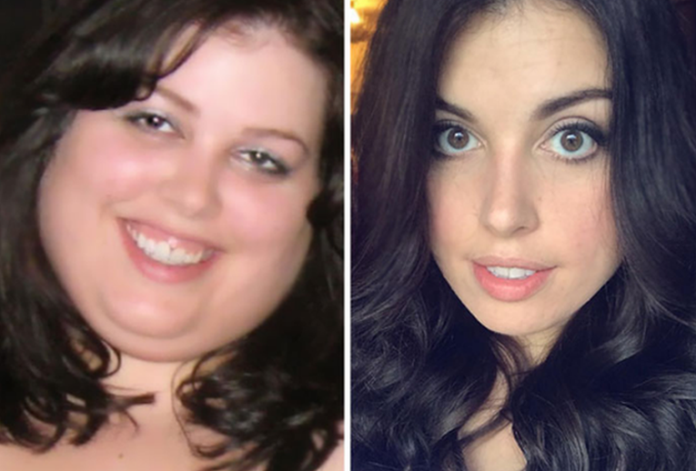Fantastične fotke prije i poslije mršavljenja otkrivaju kako gubitak kilograma utječe na izgled lica
