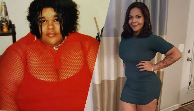 Skinula je 127 kilograma, a sad joj stranci doniraju novac da skine višak kože