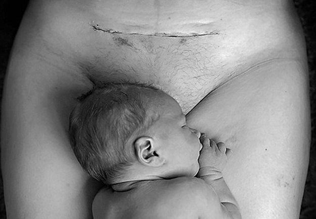 Fotografija tek rođene bebe izazvala buru na Facebooku: "Ne mogu ni opisati kako me vrijeđaju"
