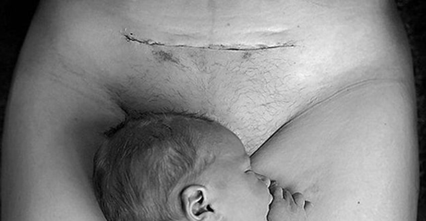 Fotografija tek rođene bebe izazvala buru na Facebooku: "Ne mogu ni opisati kako me vrijeđaju"