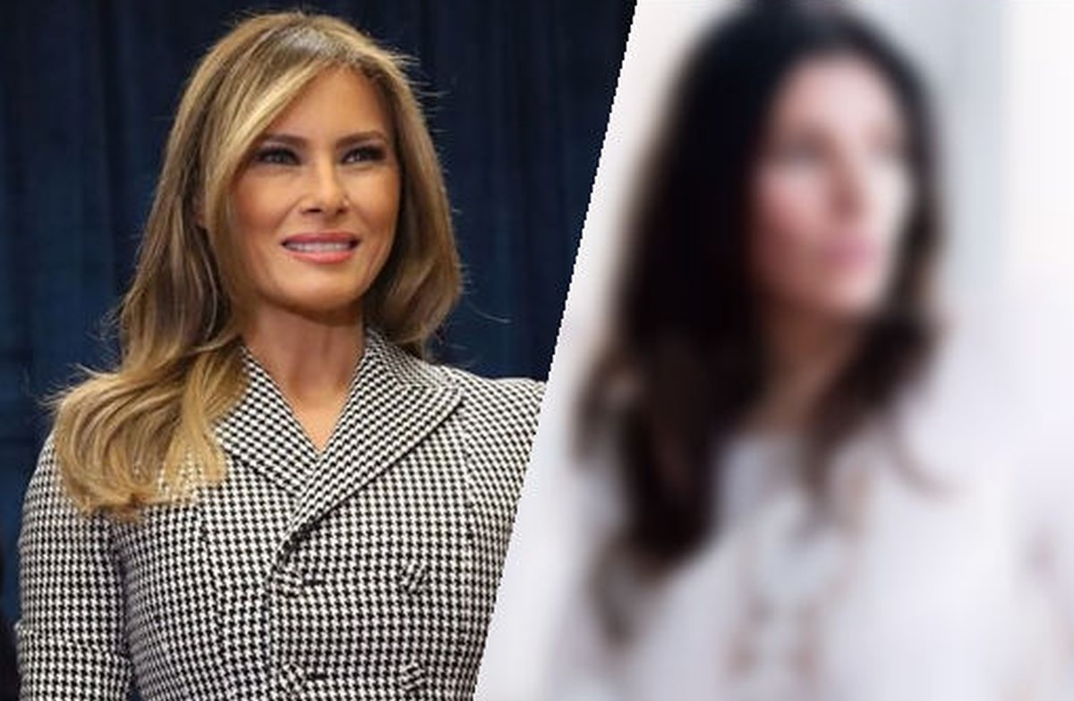FOTO Žena potrošila 318 tisuća kuna na plastične operacije kako bi izgledala kao Melania Trump