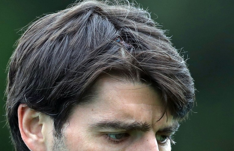FOTO Ćorluka trenirao sa šavovima