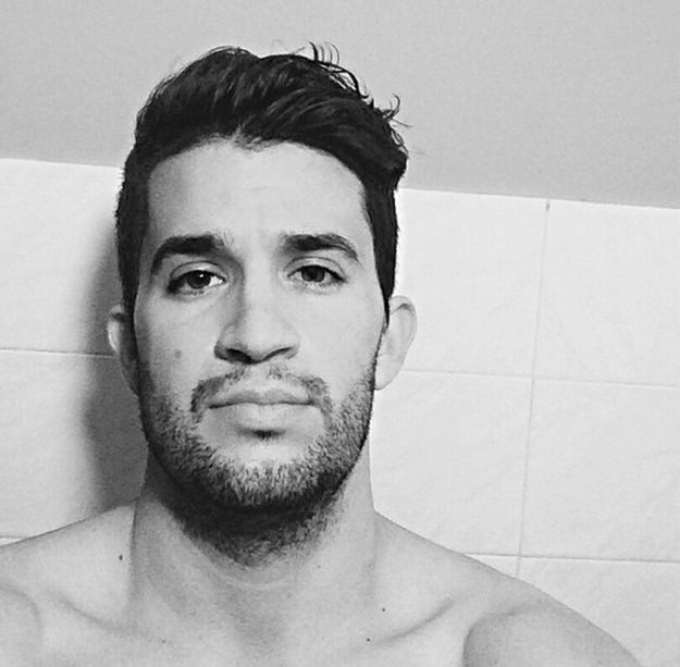 Damir Kedžo operirao čeljust: Polomili su mi pola lica