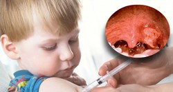 Dječak u Španjolskoj umro od difterije, roditelji odbijali cijepljenje, još osmero djece nosi virus