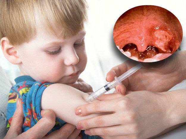 Dječak u Španjolskoj umro od difterije, roditelji odbijali cijepljenje, još osmero djece nosi virus
