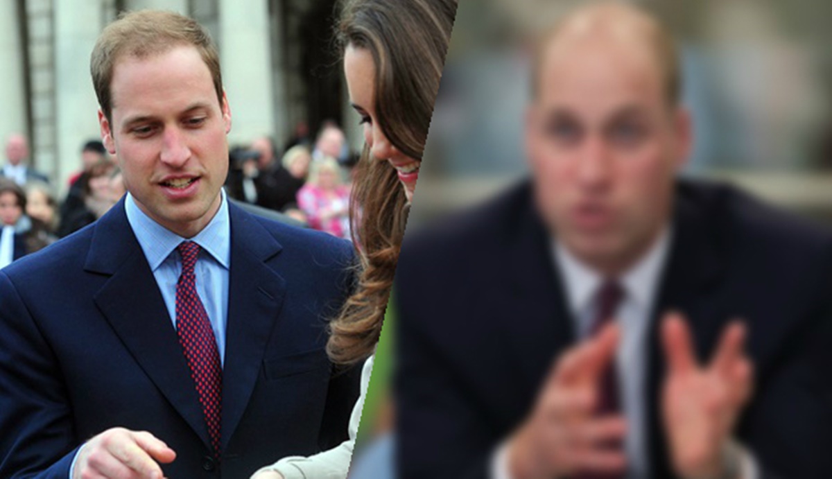 FOTO Princ William totalno promijenio izgled zbog problema kojeg je godinama sakrivao