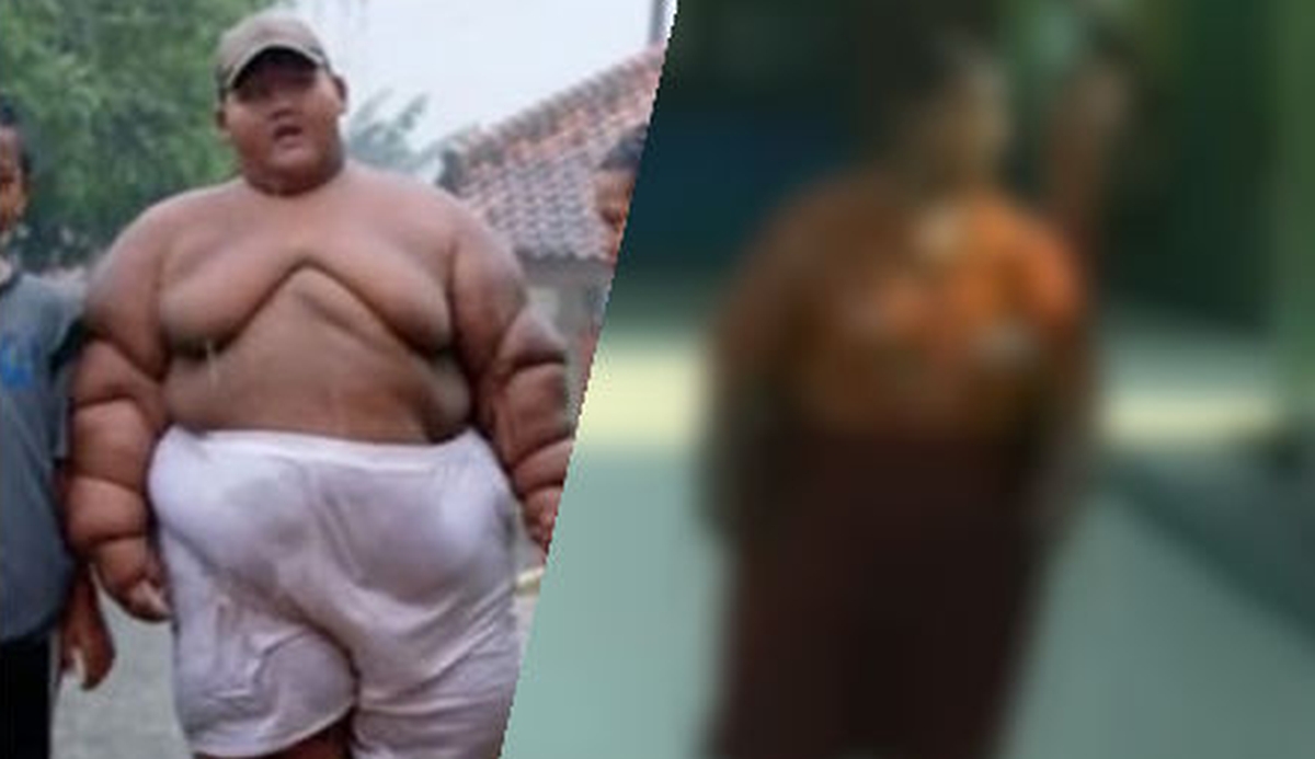 VIDEO Najdeblji dječak na svijetu izgubio je 76 kilograma i napokon se može igrati s prijateljima
