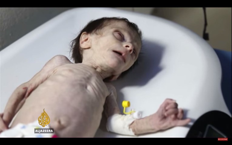 400.000 civila u Siriji suočeno je s "potpunom katastrofom", djeca umiru od gladi