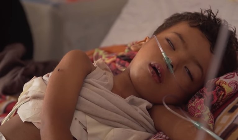 UZNEMIRUJUĆE SNIMKE Nakon 1000 dana rata, 8 milijuna ljudi u Jemenu umire od gladi