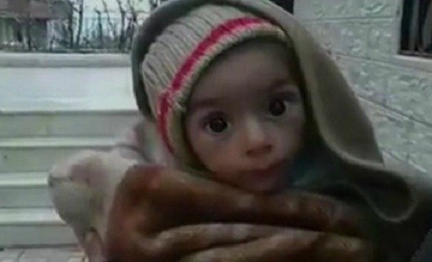 Pakao u gradu pod opsadom Assada: Djeca umiru od gladi, jedu pse, hranu traže po minskim poljima