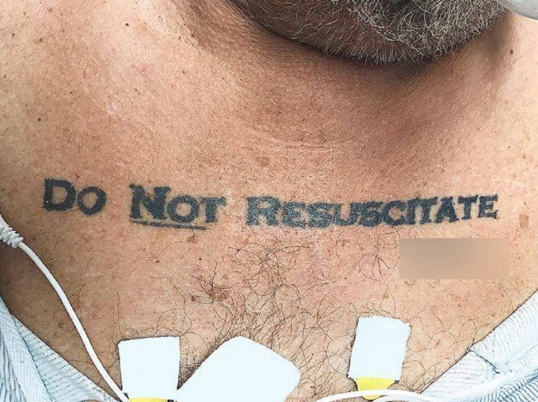 Zbog tetovaže na prsima doktori nisu znali što da rade s umirućim pacijentom koji je dovezen na hitnu