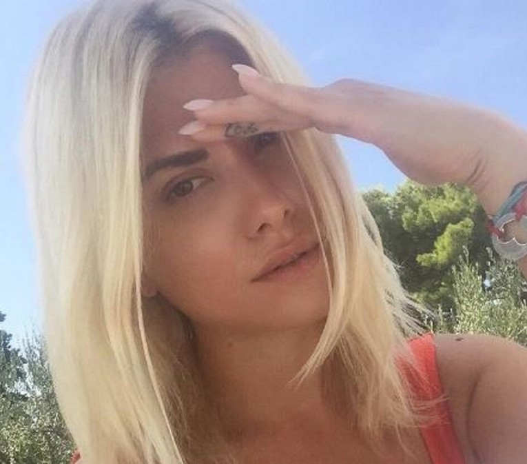 FOTO Vidite li? Eciju upozorili da joj je ispala bradavica, ona spremno objasnila što se dogodilo