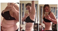 Smršavila 55 kilograma, ali sad ima novi problem: Tražila pomoć pa naišla na svakakve reakcije