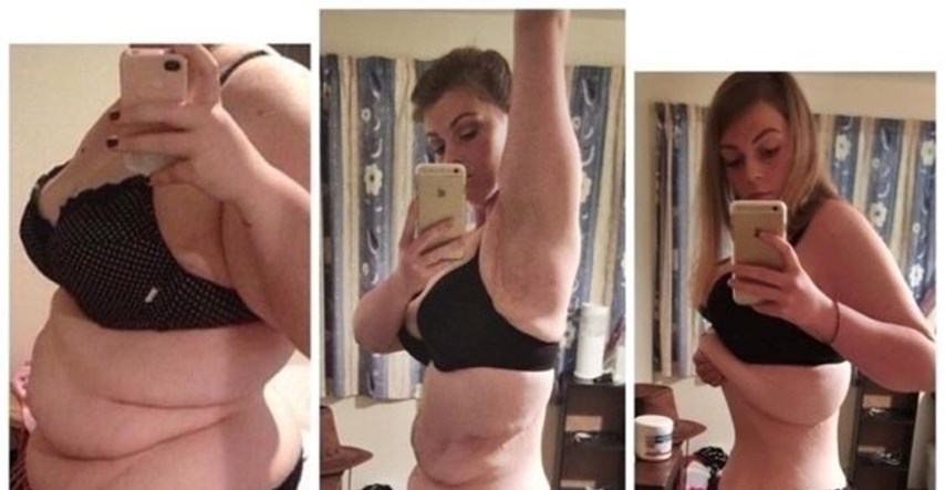 Smršavila 55 kilograma, ali sad ima novi problem: Tražila pomoć pa naišla na svakakve reakcije