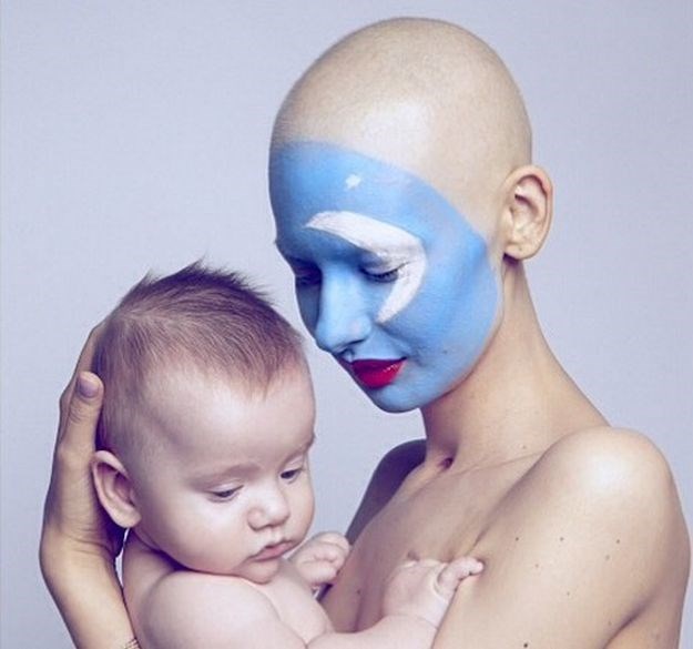 Dokaz da uvijek postoji nada: Prve fotografije manekenke koja je zbog raka ostala bez čeljusti
