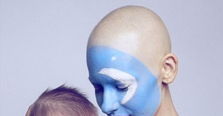 Dokaz da uvijek postoji nada: Prve fotografije manekenke koja je zbog raka ostala bez čeljusti