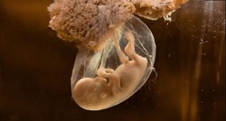 Veliki uspjeh znanstvenika: U laboratoriju razvili ljudski embrij do 13. dana